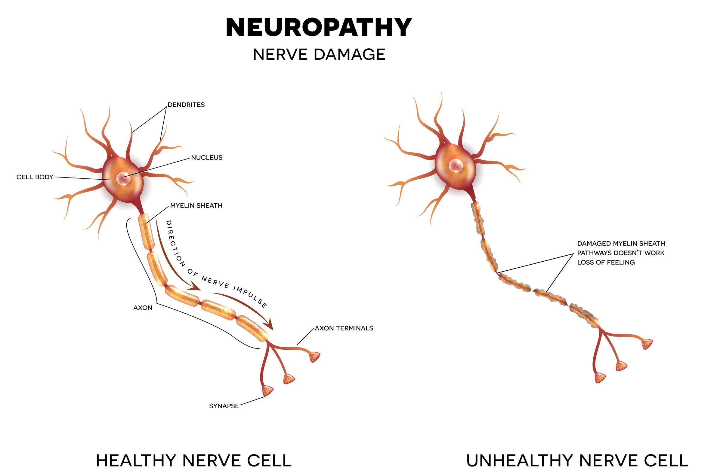 Does Massage Help Neuropathy? Let's Find Out! Ceragem